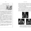 Дэвид Иглмен: Мозг. Ваша личная история